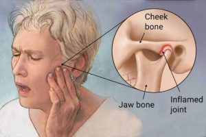 jaw pain