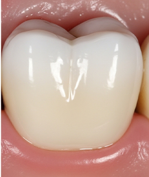 Untitled-1-Recovered312