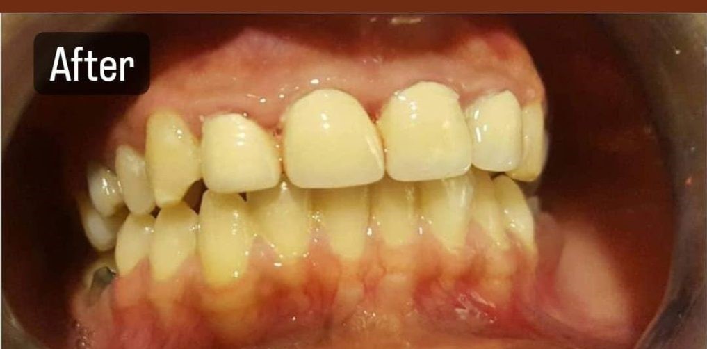 WhatsApp-Image-2024-05-29-at-14.51.45_6727952d-1017x1024 (1)