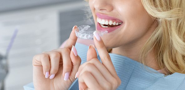 Banner for invisalign orthodontics, modern dentistry concept. Unrecognizable blonde woman with healthy white teeth holding invisible braces while sitting at dental chair, closeup portrait, copy space