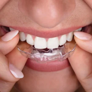 clear-aligner-dubai-1024x1024-1